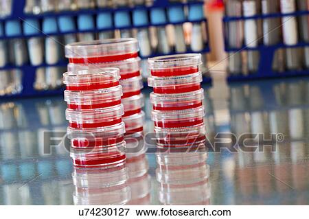 Stock Photo - Stacks of petri dishes containing scientific samples. Fotosearch