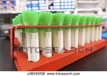 Stock Photo - Test tubes in a rack. Fotosearch