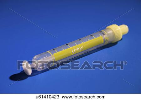 Urine sample test tube View Large Photo Image Stock Image - Urine sample test tube. Fotosearch
