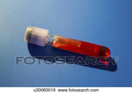 Stock Photo - Virology test tube. Fotosearch