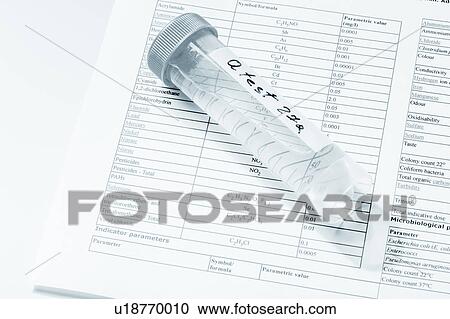 Stock Image - Water sample in a test tube. Fotosearch