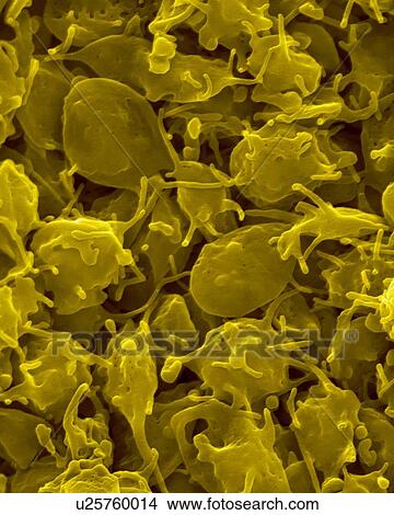 Activated platelets with channels of the open canalicular system (OCS), coloured scanning electron micrograph (SEM). Platelets are blood cell fragments that play an essential role in blood clotting and wound repair, and can also activate certain... View Large Photo Image Picture - Activated platelets with channels of the open canalicular system (OCS), coloured scanning electron micrograph (SEM). Platelets are blood cell fragments that play an essential role in blood clotting and wound repair, and can also activate certain.... Fotosearch