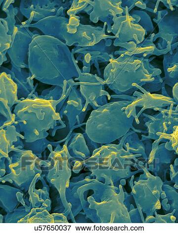 Activated platelets with channels of the open canalicular system (OCS), coloured scanning electron micrograph (SEM). Platelets are blood cell fragments that play an essential role in blood clotting and wound repair, and can also activate certain... View Large Photo Image Stock Photo - Activated platelets with channels of the open canalicular system (OCS), coloured scanning electron micrograph (SEM). Platelets are blood cell fragments that play an essential role in blood clotting and wound repair, and can also activate certain.... Fotosearch