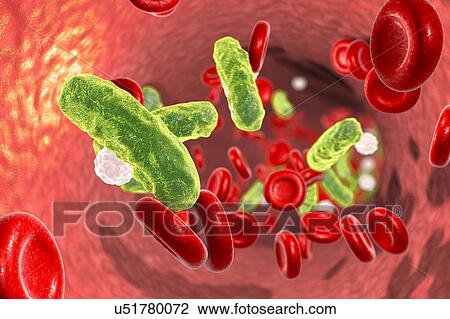 Stock Image - Bacterial blood infection, computer illustration.. Fotosearch