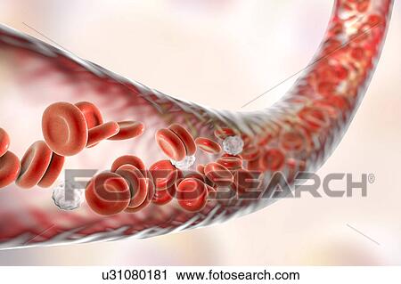 Blood vessel with blood cells, computer illustration. Red blood cells and white blood cells inside a blood vessel. View Large Photo Image Stock Image - Blood vessel with blood cells, computer illustration. Red blood cells and white blood cells inside a blood vessel.. Fotosearch