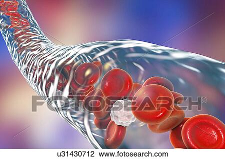 Stock Image - Blood vessel with blood cells, computer illustration. Red blood cells and white blood cells inside a blood vessel.. Fotosearch