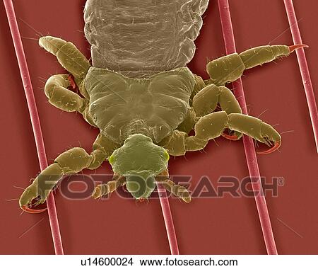 Picture - Coloured scanning electron micrograph (SEM) of Human head louse on human hair (Pediculus humanus capitis). The head louse (Pediculus humanus capitis) is an insect in the Order Psocodea (parasitic lice, formerly Order Phthiraptera/Pscocptera). Head.... Fotosearch