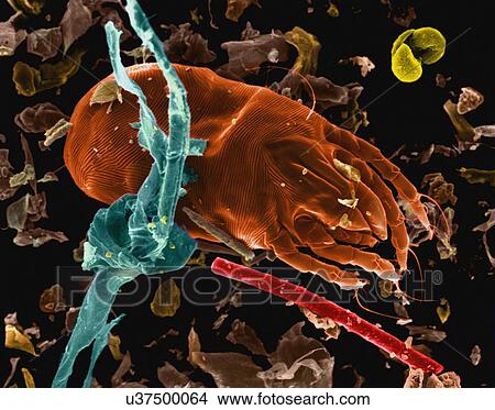 Picture - Coloured scanning electron micrograph (SEM) of Dust mite (Dermatophagoides pteronyssinus). Millions of dust mites inhabit the home, feeding on dead human skin that are common in house dust. The mite's body is in three parts: the gnathosoma (head.... Fotosearch