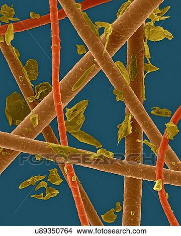 Picture - Coloured scanning electron micrograph (SEM) Pet dander: dog hair, cat hair and dead skin. Dog and cats produce human allergens. Pet dander is the material shed from the body of various animals (commonly cats and dogs). It may contain scales of dried.... Fotosearch