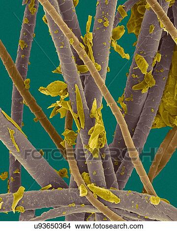 Picture - Coloured scanning electron micrograph (SEM) Pet dander. dog hair, cat hair and dead skin (cat hair. brown, dog hair. purple, dander. yellow). Dog and cats produce human allergens. Pet dander is the material shed from the body of various animals.... Fotosearch