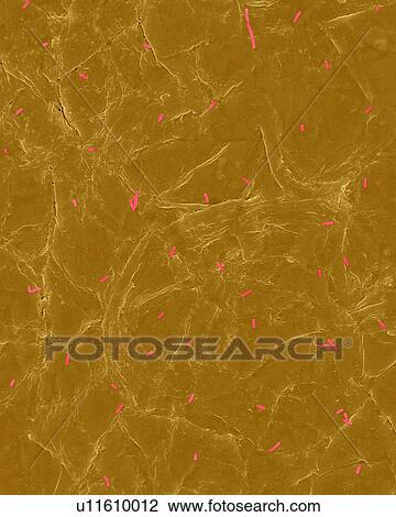 Stock Image - Coloured scanning electron micrograph (SEM) of Photocomposite, E. coli on the surface of human skin. Escherichia coli, Gram-negative, facultatively anaerobic, rod prokaryote. E. coli is part of human and animal microbiota. It can cause urinary tract.... Fotosearch