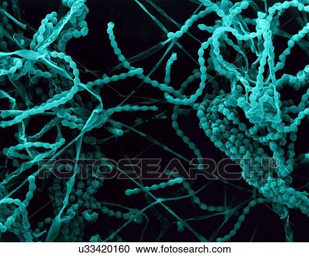 Stock Image - Coloured scanning electron micrograph (SEM) of Mould, hyphae, conidiophores (fruiting structures) and conidium (asexual spore) formation (Penicillium sp.;likely Penicillum candidum). Penicillium candidum is used to develop many soft-ripened cheeses.... Fotosearch