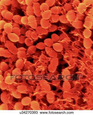 Stock Image - Coloured scanning electron micrograph (SEM) of Oral bacterium, Streptococcus mutans with surrounding dextran polysaccharide mucilage (glucan). S. mutans is a coccoid shaped, Gram-positive, facultative anaerobic bacterium that is part of the normal.... Fotosearch