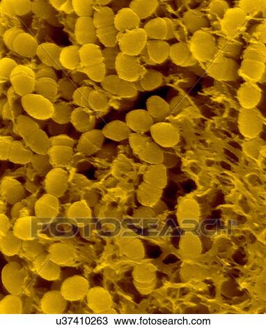 Stock Image - Coloured scanning electron micrograph (SEM) of Oral bacterium, Streptococcus mutans with surrounding dextran polysaccharide mucilage (glucan). S. mutans is a coccoid shaped, Gram-positive, facultative anaerobic bacterium that is part of the normal.... Fotosearch
