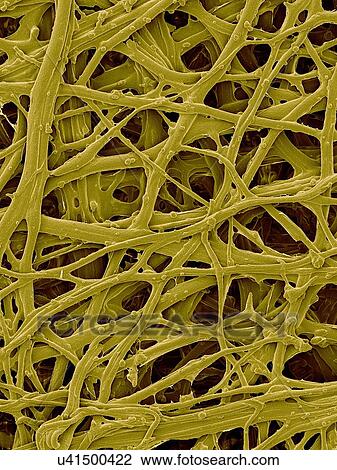 Stock Image - Coloured scanning electron micrograph (SEM) Chicken eggshell inner membrane (Gallus gallus domesticus). Shown here is the eggshell inner membrane that is composed of protein fibres (internal and attached to the hard eggshell). Several membranes are.... Fotosearch