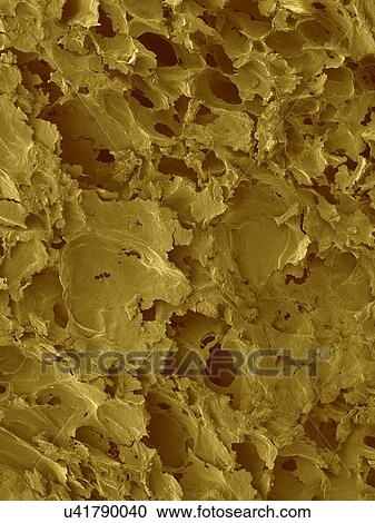 Coloured scanning electron micrograph (SEM) of White bread surface. Shown here is a slice of white sandwich bread, revealing the large airspaces that develop as a result of the action of the yeast. White bread made from wheat flour that has the bran... View Large Photo Image Stock Image - Coloured scanning electron micrograph (SEM) of White bread surface. Shown here is a slice of white sandwich bread, revealing the large airspaces that develop as a result of the action of the yeast. White bread made from wheat flour that has the bran.... Fotosearch