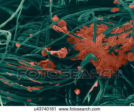Stock Image - Coloured scanning electron micrograph (SEM) of Cotton t-shirt collar with dirt, etc. embedded in fibres. A T-shirt is a style of fabric shirt, named after the T shape of the body and sleeves. It is associated with short sleeves, a round neck line and.... Fotosearch