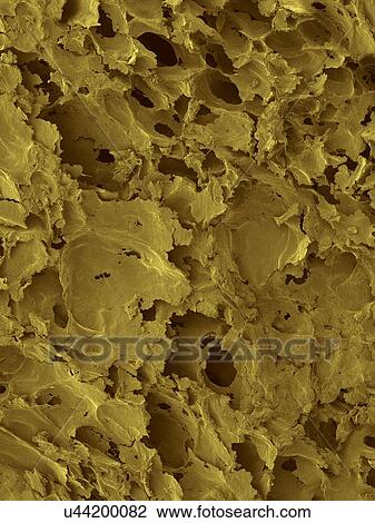 Coloured scanning electron micrograph (SEM) of White bread surface. Shown here is a slice of white sandwich bread, revealing the large airspaces that develop as a result of the action of the yeast. White bread made from wheat flour that has the bran... View Large Photo Image Stock Image - Coloured scanning electron micrograph (SEM) of White bread surface. Shown here is a slice of white sandwich bread, revealing the large airspaces that develop as a result of the action of the yeast. White bread made from wheat flour that has the bran.... Fotosearch