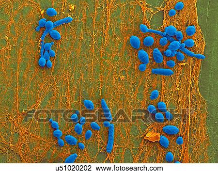Stock Image - Coloured scanning electron micrograph (SEM) of Candida albicans infected medical catheter. A common yeast, C. albicans can colonize catheters resulting in serious tissue infections. Shown here is the inner surface of an infected catheter (removed from.... Fotosearch
