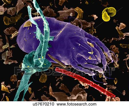 Coloured scanning electron micrograph (SEM) of Dust mite (Dermatophagoides pteronyssinus). Millions of dust mites inhabit the home, feeding on dead human skin that are common in house dust. The mite's body is in three parts: the gnathosoma (head... View Large Photo Image Stock Image - Coloured scanning electron micrograph (SEM) of Dust mite (Dermatophagoides pteronyssinus). Millions of dust mites inhabit the home, feeding on dead human skin that are common in house dust. The mite's body is in three parts: the gnathosoma (head.... Fotosearch