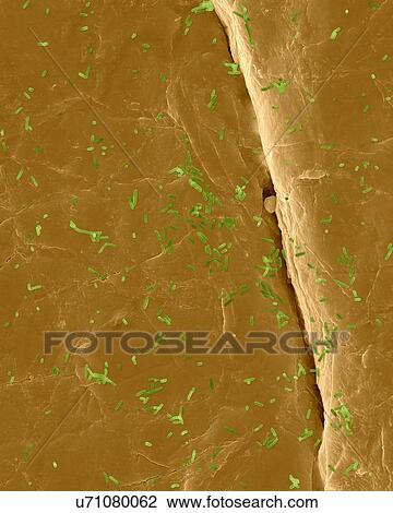 Stock Image - Coloured scanning electron micrograph (SEM) of Photocomposite, E. coli on the surface of human skin. Escherichia coli is a Gram-negative, facultatively anaerobic, enteric, rod prokaryote. This bacterium is normally a part of the human and animal.... Fotosearch