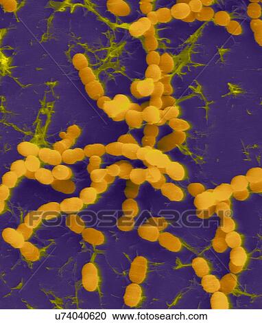 Coloured scanning electron micrograph (SEM) of Streptococcus thermophilus, Gram-positive, coccoid prokaryote (bacterium). Streptococcus thermophilus (also known as: Streptococcus salivarius subsp. thermophilus) is a facultative anaerobe that belongs... View Large Photo Image Stock Image - Coloured scanning electron micrograph (SEM) of Streptococcus thermophilus, Gram-positive, coccoid prokaryote (bacterium). Streptococcus thermophilus (also known as: Streptococcus salivarius subsp. thermophilus) is a facultative anaerobe that belongs.... Fotosearch