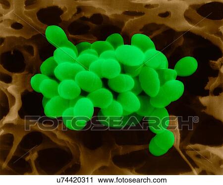 Stock Image - Coloured scanning electron micrograph (SEM) of Enterococcus faecalis (formerly known as Streptococcus faecalis), Gram positive, coccoid prokaryote (dividing); causes skin and wound infections such as scalded skin syndrome, scarlet fever, erysipelas.... Fotosearch