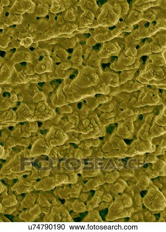 Coloured scanning electron micrograph (SEM) Emu eggshell surface with tiny pores (Dromaius novaehollandiae). Calcium carbonate crystals make up the Emu eggshell. Bird eggshells are semipermeable membranes composed of mineralized calcium carbonate and... View Large Photo Image Stock Image - Coloured scanning electron micrograph (SEM) Emu eggshell surface with tiny pores (Dromaius novaehollandiae). Calcium carbonate crystals make up the Emu eggshell. Bird eggshells are semipermeable membranes composed of mineralized calcium carbonate and.... Fotosearch