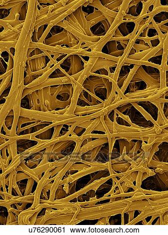 Coloured scanning electron micrograph (SEM) Chicken eggshell inner membrane (Gallus gallus domesticus). Shown here is the eggshell inner membrane that is composed of protein fibres (internal and attached to the hard eggshell). Several membranes are... View Large Photo Image Stock Image - Coloured scanning electron micrograph (SEM) Chicken eggshell inner membrane (Gallus gallus domesticus). Shown here is the eggshell inner membrane that is composed of protein fibres (internal and attached to the hard eggshell). Several membranes are.... Fotosearch