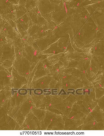 Coloured scanning electron micrograph (SEM) of Photocomposite, E. coli on the surface of human skin. Escherichia coli, Gram-negative, facultatively anaerobic, rod prokaryote. E. coli is part of human and animal microbiota. It can cause urinary tract... View Large Photo Image Stock Image - Coloured scanning electron micrograph (SEM) of Photocomposite, E. coli on the surface of human skin. Escherichia coli, Gram-negative, facultatively anaerobic, rod prokaryote. E. coli is part of human and animal microbiota. It can cause urinary tract.... Fotosearch
