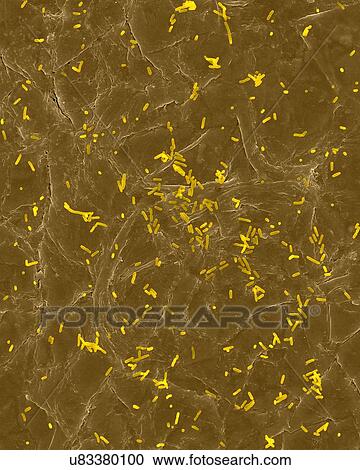 Coloured scanning electron micrograph (SEM) of Photocomposite, E. coli on the surface of human skin. Escherichia coli is a Gram-negative, facultatively anaerobic, enteric, rod prokaryote. This bacterium is normally a part of the human and animal... View Large Photo Image Stock Image - Coloured scanning electron micrograph (SEM) of Photocomposite, E. coli on the surface of human skin. Escherichia coli is a Gram-negative, facultatively anaerobic, enteric, rod prokaryote. This bacterium is normally a part of the human and animal.... Fotosearch