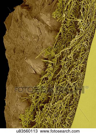 Coloured scanning electron micrograph (SEM) Chicken eggshell cross section (Gallus gallus domesticus). Shown from left to right in the image. hard mineralized eggshell, internal fibrous membrane and smooth inner surface of the internal membrane. The... View Large Photo Image Stock Image - Coloured scanning electron micrograph (SEM) Chicken eggshell cross section (Gallus gallus domesticus). Shown from left to right in the image. hard mineralized eggshell, internal fibrous membrane and smooth inner surface of the internal membrane. The.... Fotosearch