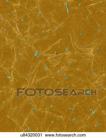 Stock Image - Coloured scanning electron micrograph (SEM) of Photocomposite, E. coli on the surface of human skin. Escherichia coli, Gram-negative, facultatively anaerobic, rod prokaryote. E. coli is part of human and animal microbiota. It can cause urinary tract.... Fotosearch