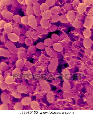 Coloured scanning electron micrograph (SEM) of Oral bacterium, Streptococcus mutans with surrounding dextran polysaccharide mucilage (glucan). S. mutans is a coccoid shaped, Gram-positive, facultative anaerobic bacterium that is part of the normal... View Large Photo Image Stock Image - Coloured scanning electron micrograph (SEM) of Oral bacterium, Streptococcus mutans with surrounding dextran polysaccharide mucilage (glucan). S. mutans is a coccoid shaped, Gram-positive, facultative anaerobic bacterium that is part of the normal.... Fotosearch