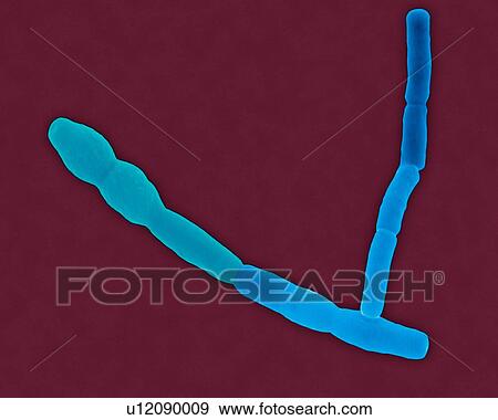 Stock Photo - Coloured scanning electron micrograph (SEM) of Bacillus cereus, Gram-positive, encapsulated, rod prokaryote (vegetative and spore stages); dividing. Causes food poisoning. Bacillus cereus, Gram-positive, encapsulated, rod prokaryote; causes food.... Fotosearch