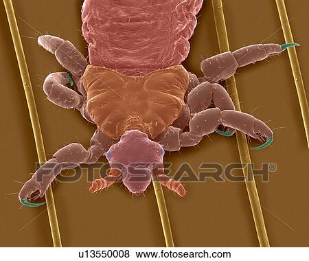 Stock Photo - Coloured scanning electron micrograph (SEM) of Human head louse on human hair (Pediculus humanus capitis). The head louse (Pediculus humanus capitis) is an insect in the Order Psocodea (parasitic lice, formerly Order Phthiraptera/Pscocptera). Head.... Fotosearch