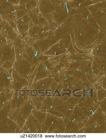 Coloured scanning electron micrograph (SEM) of Photocomposite, E. coli on the surface of human skin. Escherichia coli, Gram-negative, facultatively anaerobic, rod prokaryote. E. coli is part of human and animal microbiota. It can cause urinary tract... View Large Photo Image Stock Photo - Coloured scanning electron micrograph (SEM) of Photocomposite, E. coli on the surface of human skin. Escherichia coli, Gram-negative, facultatively anaerobic, rod prokaryote. E. coli is part of human and animal microbiota. It can cause urinary tract.... Fotosearch