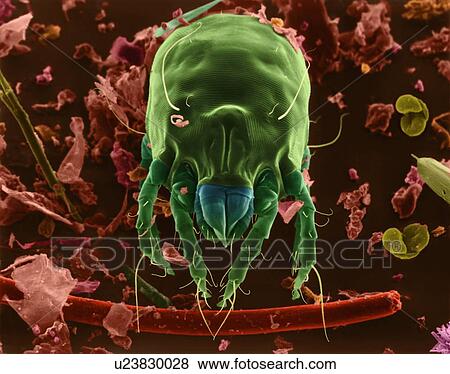 Stock Photo - Coloured scanning electron micrograph (SEM) of Dust mite (Dermatophagoides sp. ). Millions of dust mites inhabit the home, feeding on dead human skin that are common in house dust. The mite's body is in three parts: the gnathosoma (head region) adapted.... Fotosearch