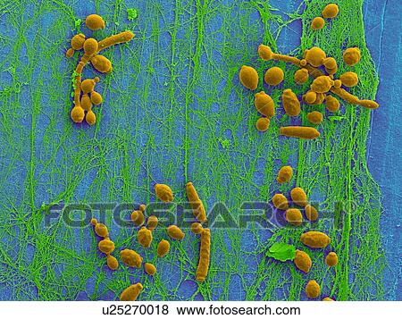 Stock Photo - Coloured scanning electron micrograph (SEM) of Candida albicans infected medical catheter. A common yeast, C. albicans can colonize catheters resulting in serious tissue infections. Shown here is the inner surface of an infected catheter (removed from.... Fotosearch