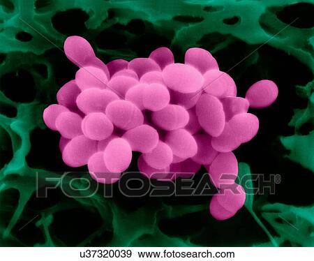 Stock Photo - Coloured scanning electron micrograph (SEM) of Enterococcus faecalis (formerly known as Streptococcus faecalis), Gram positive, coccus prokaryote (dividing); causes skin and wound infections such as scalded skin syndrome, scarlet fever, erysipelas and.... Fotosearch