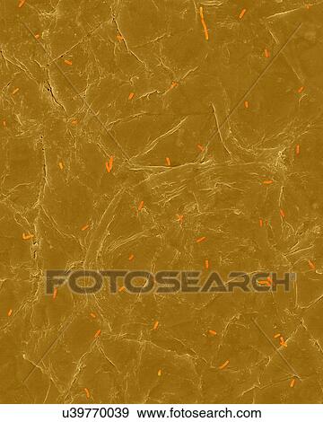 Stock Photo - Coloured scanning electron micrograph (SEM) of Photocomposite, E. coli on the surface of human skin. Escherichia coli, Gram-negative, facultatively anaerobic, rod prokaryote. E. coli is part of human and animal microbiota. It can cause urinary tract.... Fotosearch