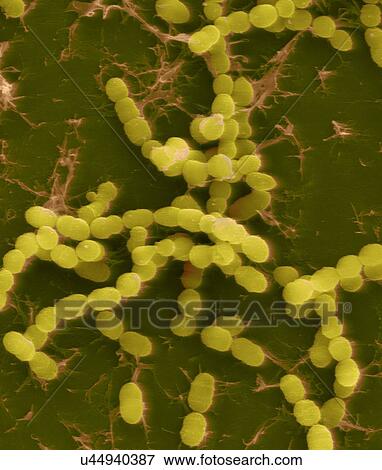 Coloured scanning electron micrograph (SEM) of Streptococcus thermophilus, Gram-positive, coccoid prokaryote (bacterium). Streptococcus thermophilus (also known as: Streptococcus salivarius subsp. thermophilus) is a facultative anaerobe that belongs... View Large Photo Image Stock Photo - Coloured scanning electron micrograph (SEM) of Streptococcus thermophilus, Gram-positive, coccoid prokaryote (bacterium). Streptococcus thermophilus (also known as: Streptococcus salivarius subsp. thermophilus) is a facultative anaerobe that belongs.... Fotosearch