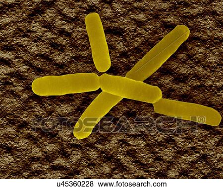 Stock Photo - Coloured scanning electron micrograph (SEM) of Bradyrhizobium is a genus of Gram-negative, soil bacteria in the family Bradyrhizobiaceae. Many of the species of this genus fix nitrogen. It forms symbiotic relationship with modulated plant root systems.... Fotosearch