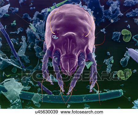 Coloured scanning electron micrograph (SEM) of Dust mite (Dermatophagoides sp. ). Millions of dust mites inhabit the home, feeding on dead human skin that are common in house dust. The mite's body is in three parts: the gnathosoma (head region) adapted... View Large Photo Image Stock Photo - Coloured scanning electron micrograph (SEM) of Dust mite (Dermatophagoides sp. ). Millions of dust mites inhabit the home, feeding on dead human skin that are common in house dust. The mite's body is in three parts: the gnathosoma (head region) adapted.... Fotosearch