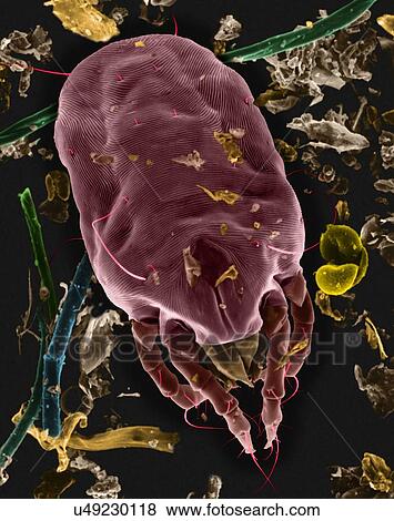 Stock Photo - Coloured scanning electron micrograph (SEM) of Dust mite (Dermatophagoides sp. ). Millions of dust mites inhabit the home, feeding on dead human skin that are common in house dust. The mite's body is in three parts: the gnathosoma (head region) adapted.... Fotosearch