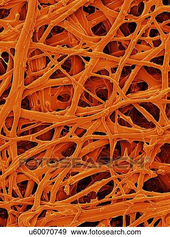 Stock Photo - Coloured scanning electron micrograph (SEM) Chicken eggshell inner membrane (Gallus gallus domesticus). Shown here is the eggshell inner membrane that is composed of protein fibres (internal and attached to the hard eggshell). Several membranes are.... Fotosearch