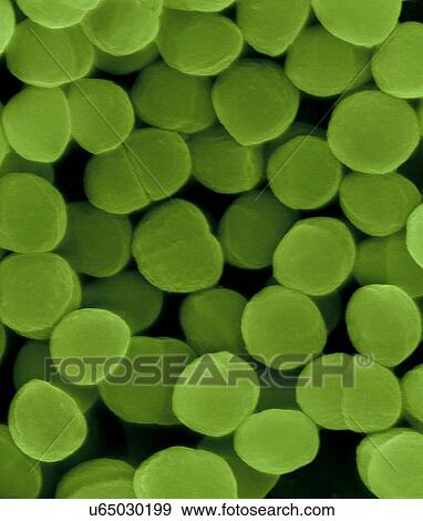 Stock Photo - Coloured scanning electron micrograph (SEM) of Staphylococcus warneri, coccoid, Gram-positive prokaryote. Staphylococcus warneri is a common commensal bacterium found on the skin of humans and animals. It is a coagulase-negative Staphylococcus sp..... Fotosearch