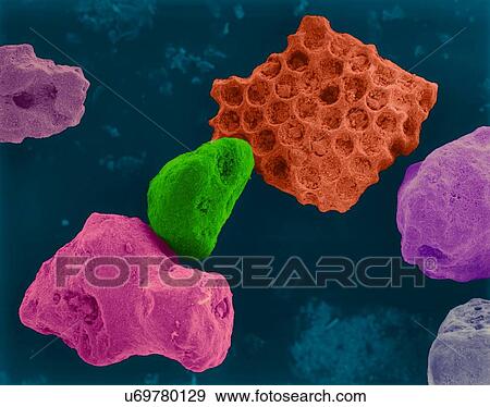 Stock Photo - Coloured scanning electron micrograph (SEM) of Coral sand (Kailua, Hawaii). Beach sand contains both rock minerals and skeletons that have been derived from living organisms (such as coral). Sand grains produced from coral have fine holes and are.... Fotosearch