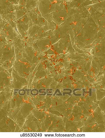 Stock Photo - Coloured scanning electron micrograph (SEM) of Photocomposite, E. coli on the surface of human skin. Escherichia coli is a Gram-negative, facultatively anaerobic, enteric, rod prokaryote. This bacterium is normally a part of the human and animal.... Fotosearch