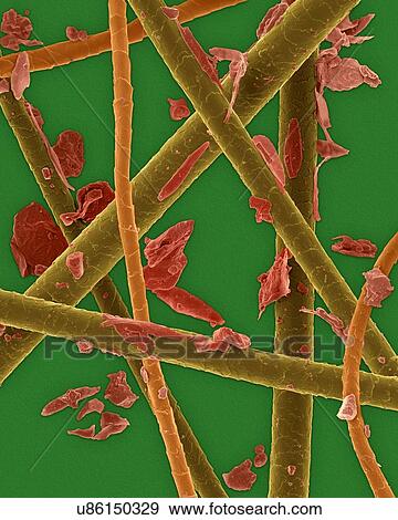 Stock Photo - Coloured scanning electron micrograph (SEM) Pet dander: dog hair, cat hair and dead skin. Dog and cats produce human allergens. Pet dander is the material shed from the body of various animals (commonly cats and dogs). It may contain scales of dried.... Fotosearch